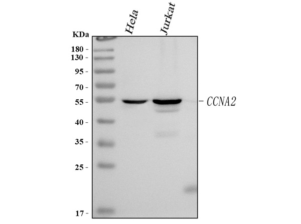 Western blot analysis of Cyclin A